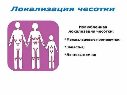 Чесо