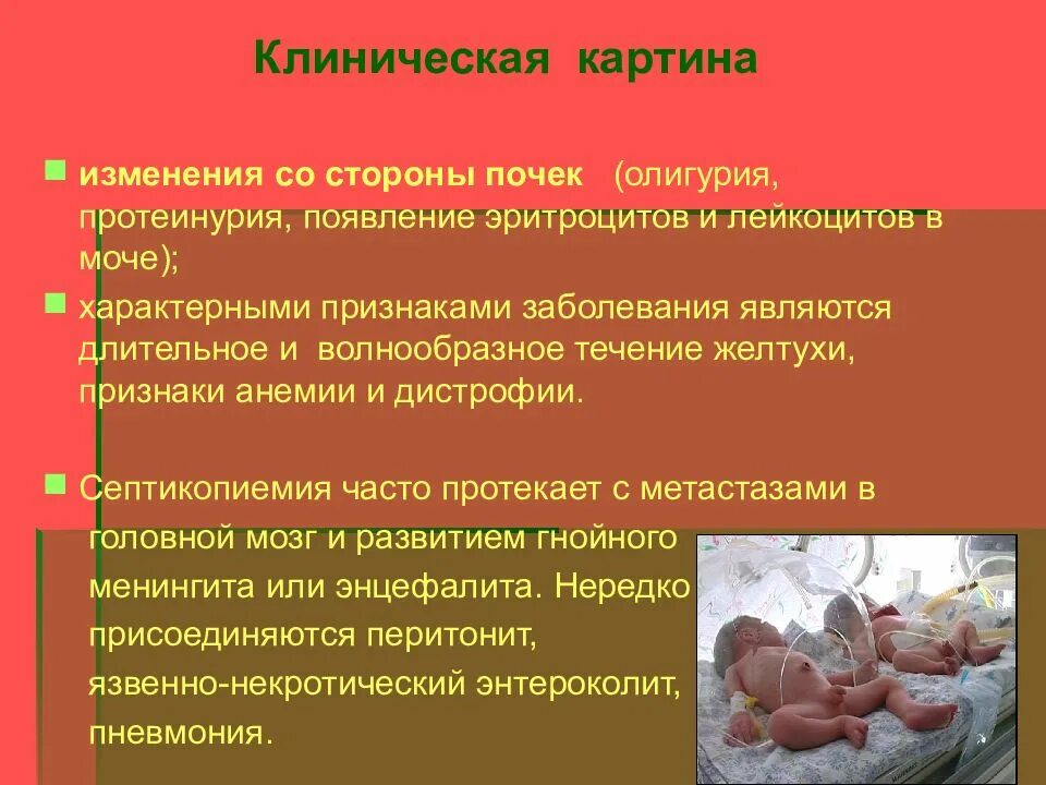 Сепсис у детей клинические. Клинические симптомы сепсиса у новорожденных детей. Сепсис новорожденного этиология. Терапия сепсиса. Сепсис у детей клинические симптомы.