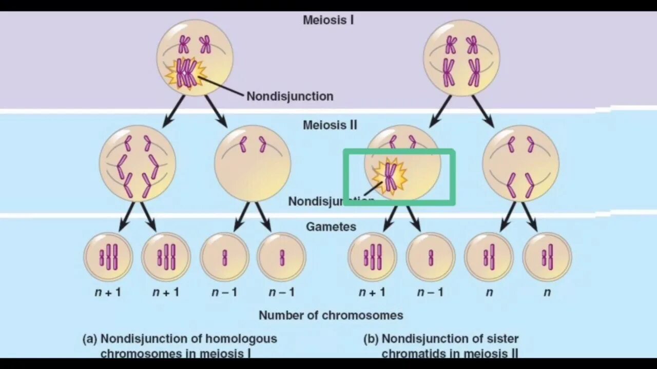 Случайное сочетание негомологичных хромосом в мейозе. Анеуплоидный набор хромосом. Нерасхождение хромосом в мейозе. Анеуплоидия это в генетике.