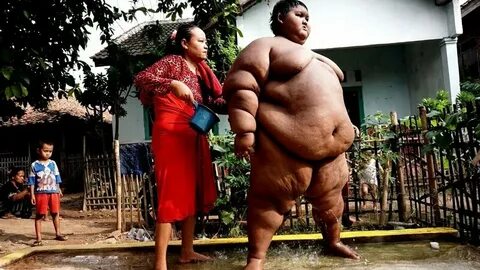 Семіз адамдар төрт тағандап жүреді (фото)