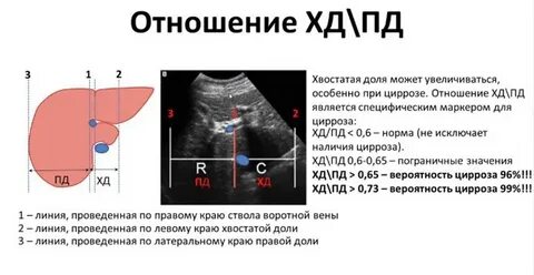 Пзр долей печени норма