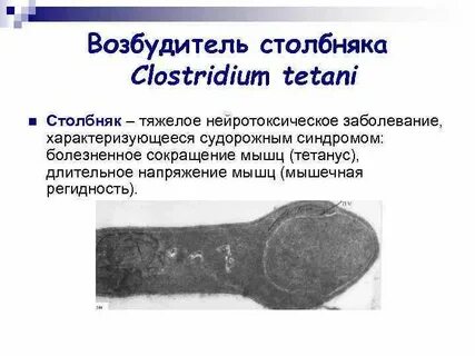 Возбудителем столбняка является