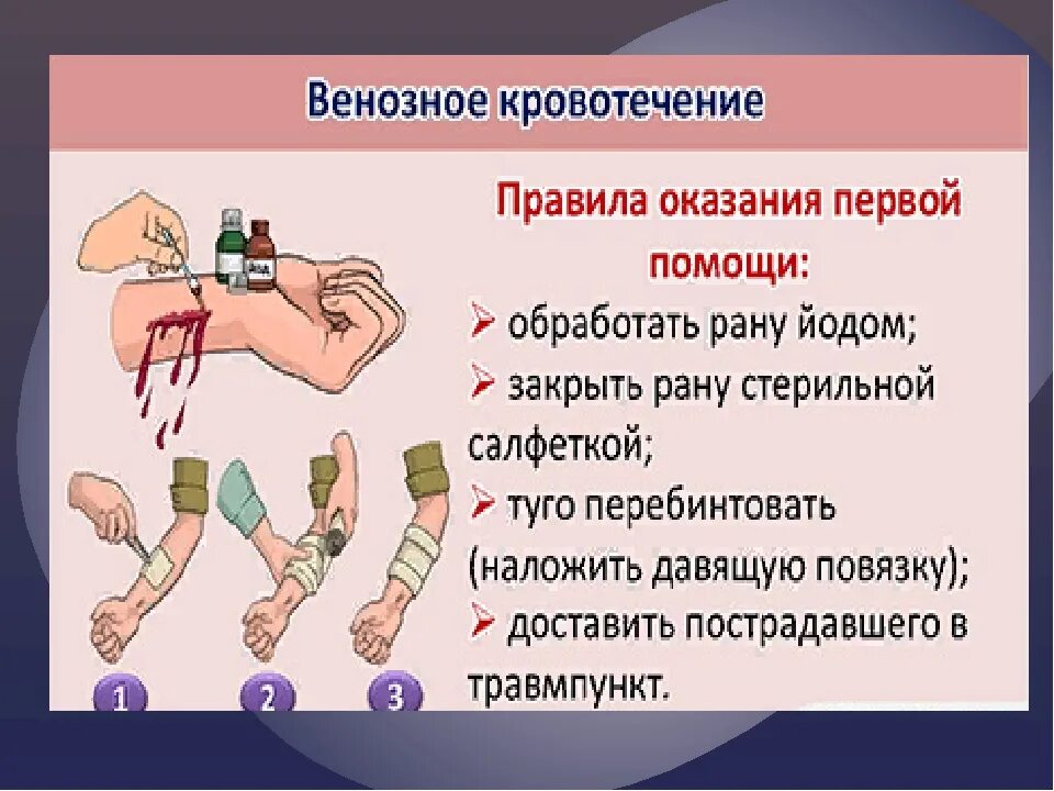 Способы остановки венозного кровотечения. Остановка при венозном кровотечении. Первая помощь при венозном кровотечении. Венозное кровотечение первая помощь. Эффективный и доступный метод остановки венозного