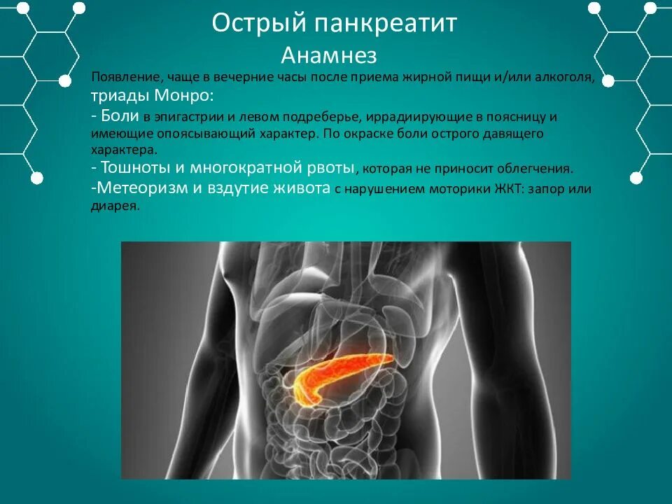 Плотный остро. Панкреатит острый панкреатит. Острый панкреатит презентация. Панкреатит анамнез.