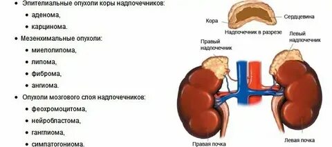 Рак надпочечников симптомы признаки у женщин