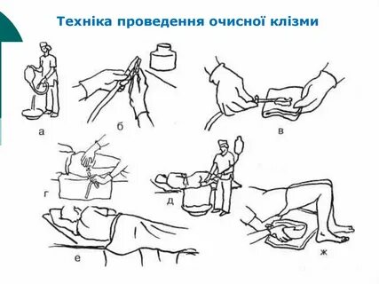 Массаж простаты пальцем мужу