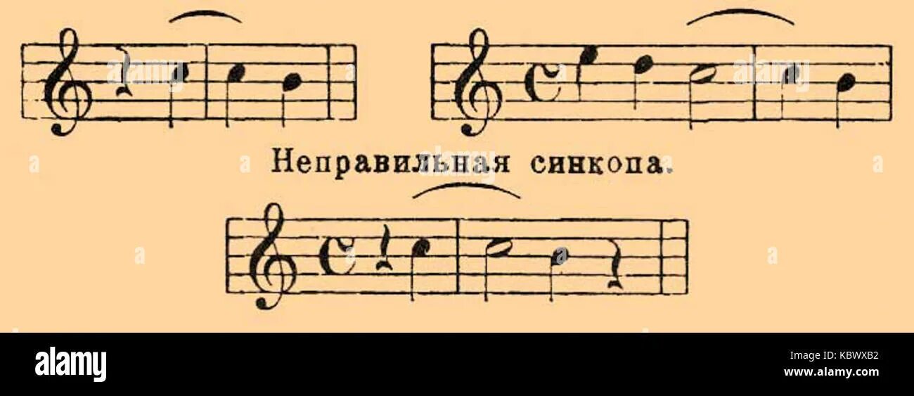Синкопа в музыке примеры. Внутритактовая синкопа сольфеджио. Межтактовая синкопа. Синкопа в музыке что это простыми словами. Синкопа между тактами.