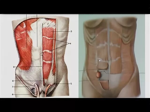 Прямые мышцы живота у мужчин. Передняя брюшная стенка диафрагма. Мышцы передней брюшной стенки живота.