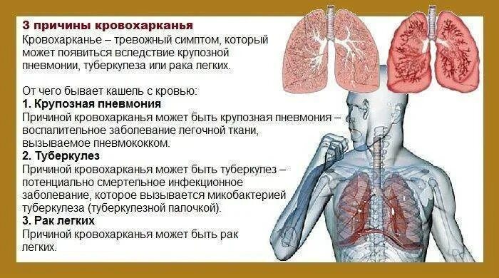 Жидкие отходы больных туберкулезом рвотные массы