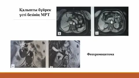 Жетілген, үлкен аналармен порно