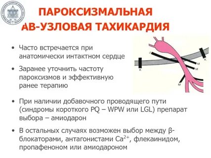 Ав тахикардия