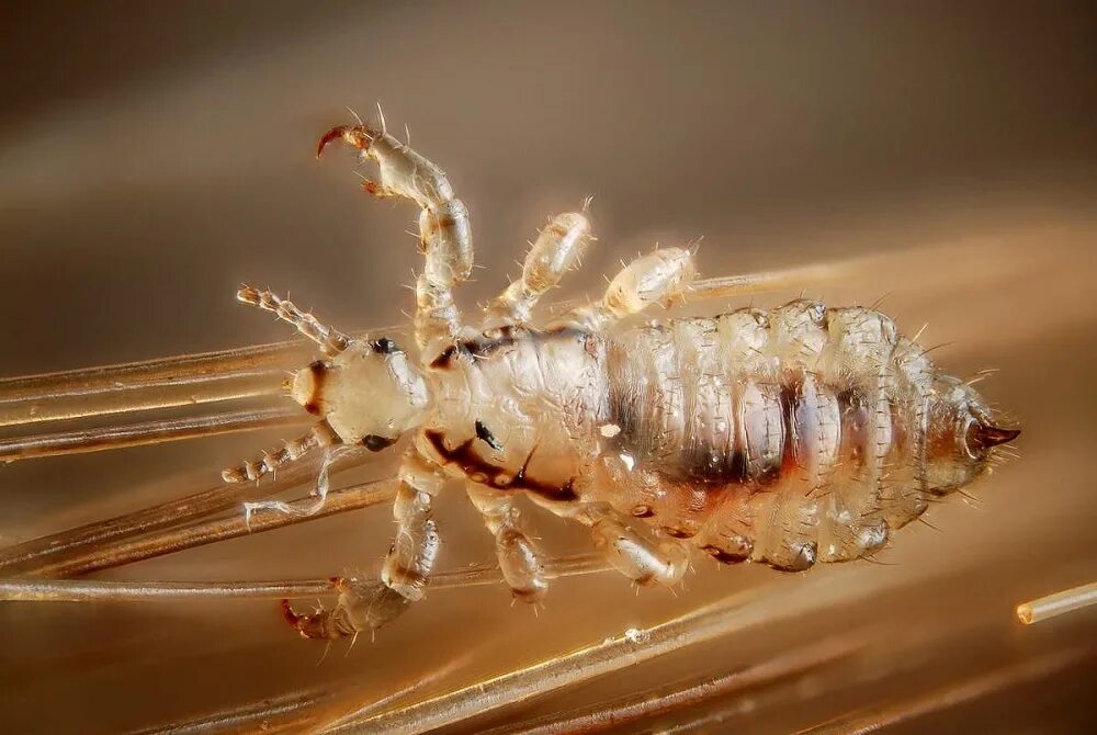 Отряд пухоеды и вши. Головная вошь (Pediculus humanus capitis). Платяная вошь (Pediculus humanus corporis).