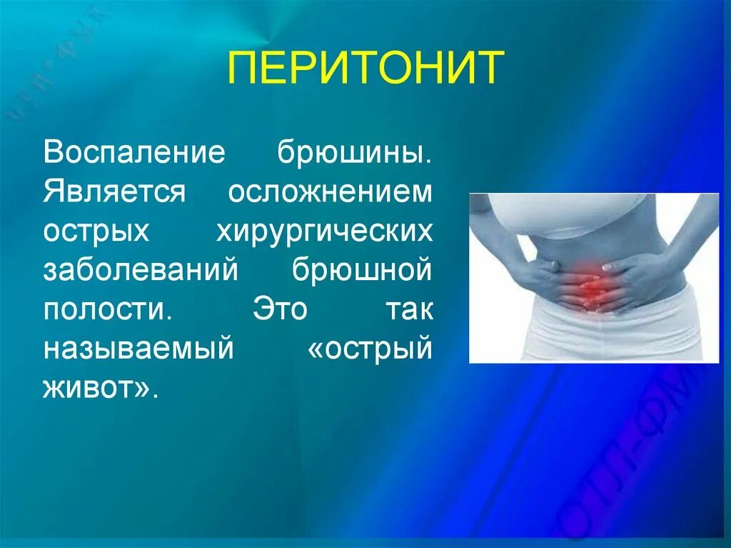 Острый живот у взрослого. Острый живот. Острый живот заболевания. Осложнения острого живота.