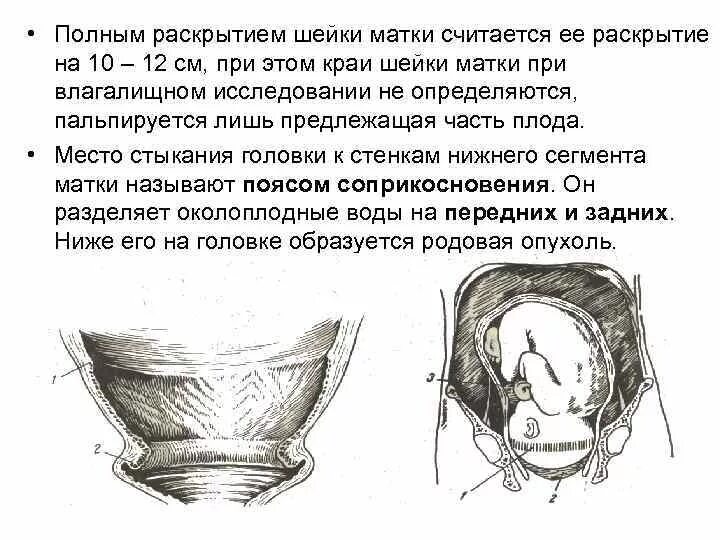 Почему раскрывается матка. Шейка матки 10 см при беременности. Роды раскрытие шейки матки 10см. Перечислить причины раскрытия шейки матки. Раскрытие шейки матки 10 см.