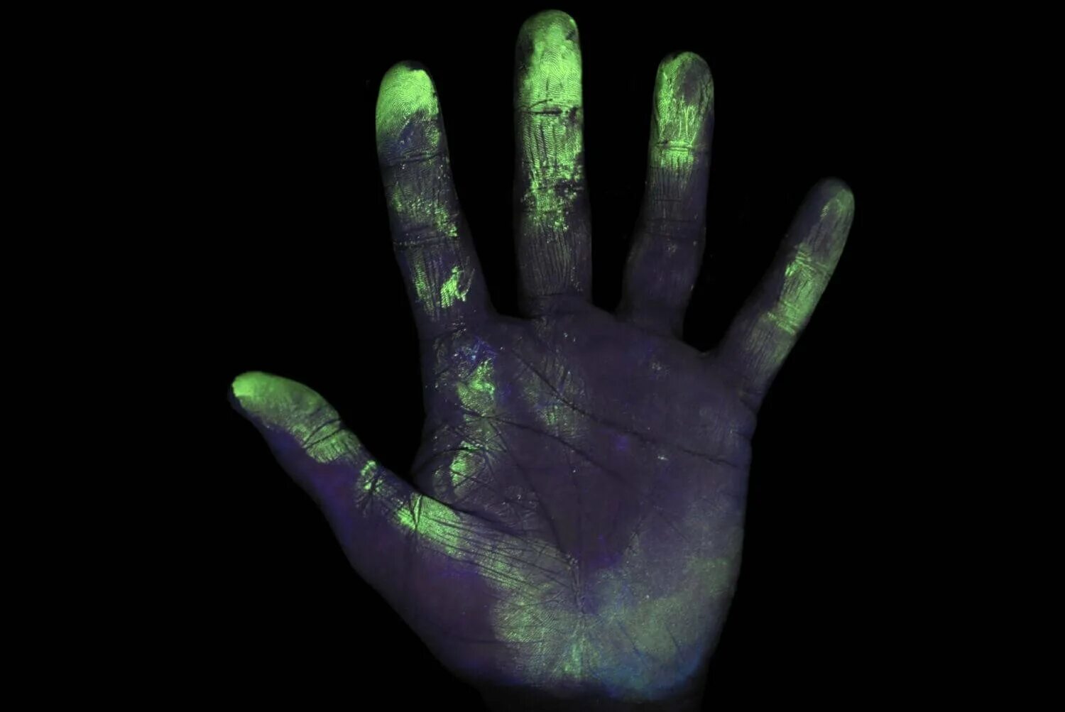 Ультрафиолетовые лучи человек. Линии Блашко в ультрафиолете. Бактерии под ультрафиолетом. Бактерии на руках.