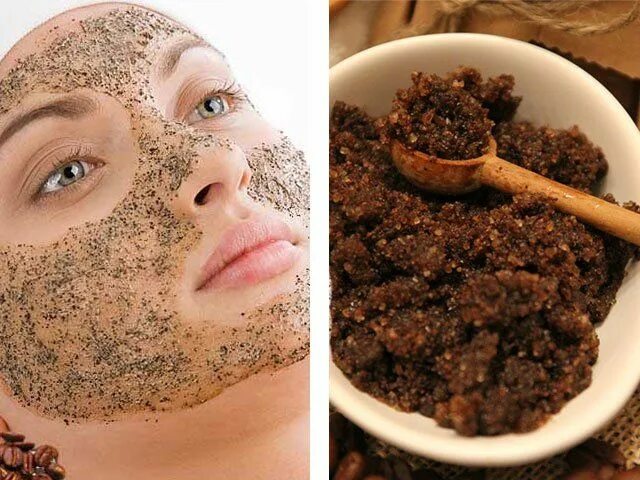 Через сколько можно делать пилинг. Химический пилинг для лица с тса. Ретиноловый пилинг акне. Лазерная шлифовка лица до и после. Через сколько можно делать пилинг.