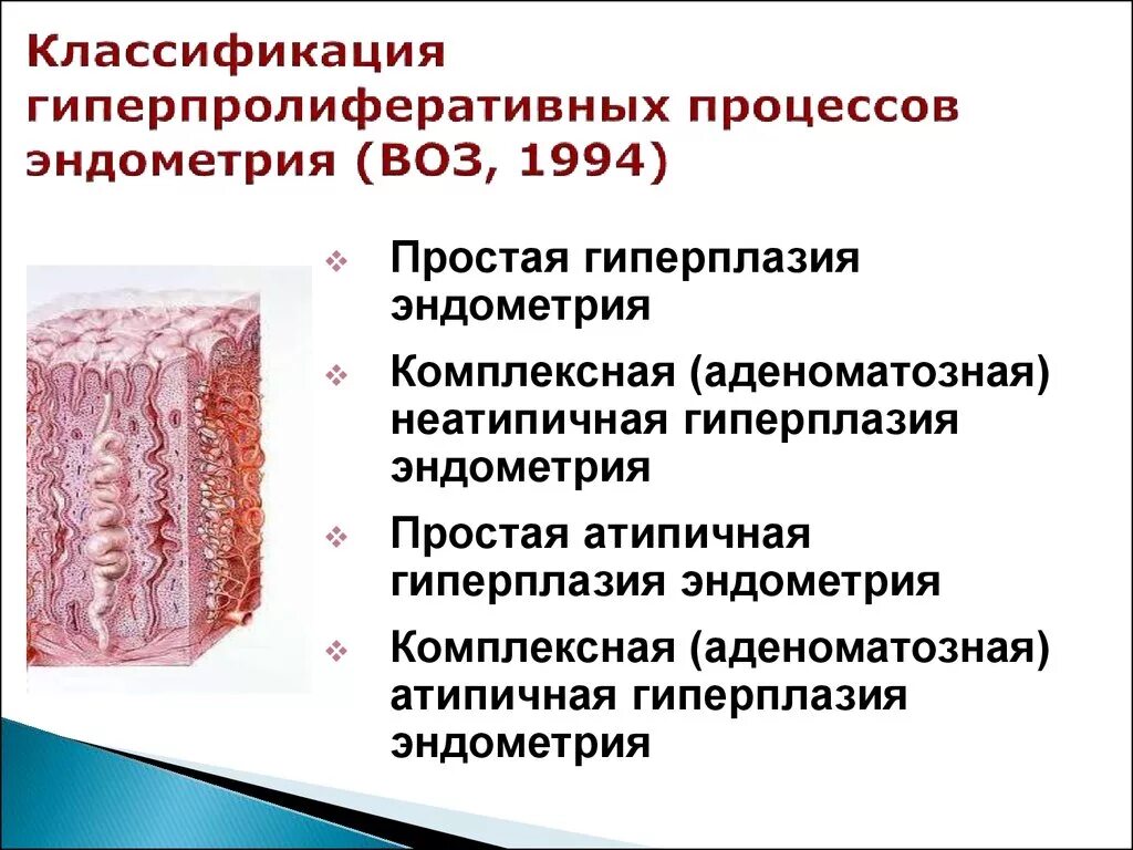 Распространенность гиперплазии эндометрия. Гиперплазия эндометрия гистология. Классификация гиперпластических процессов эндометрия воз. Атипическая гиперплазия эндометрия гистология.