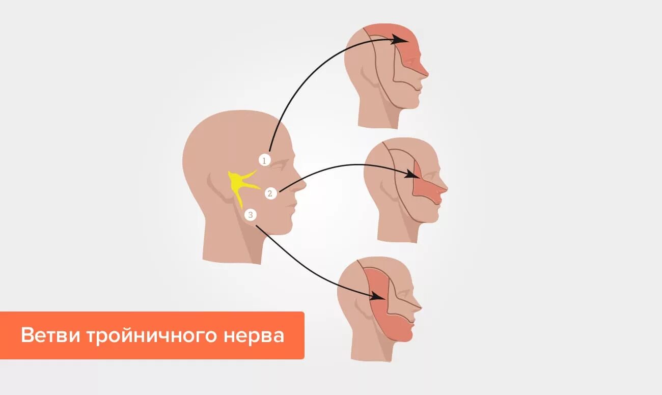 Как отличить зубную боль от тройничного. Неврит 2 ветви тройничного нерва. Невралгия 3 ветви тройничного нерва. Постгерпетическая невропатия тройничного нерва. Неврит первой ветви тройничного нерва.