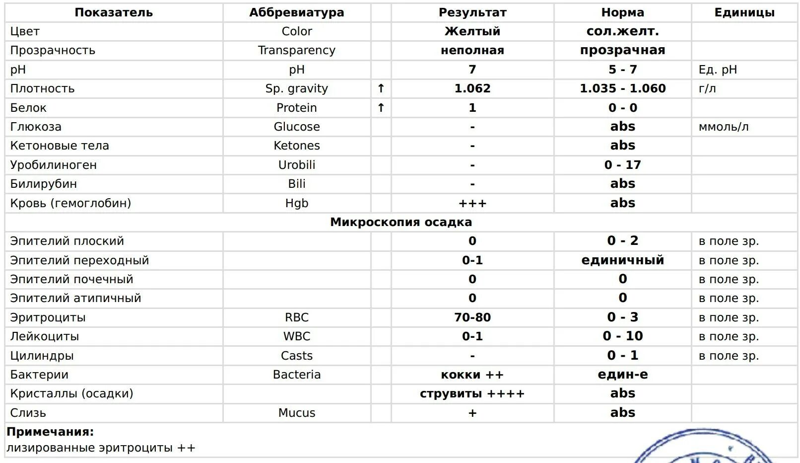 Уробилиноген в моче повышен у мужчин. Единицы измерения уробилиногена в моче. Норма уробилиногена в моче показатели. Уробилиноген норма в моче в мкмоль/л. Уробилиноген в моче норма у детей.