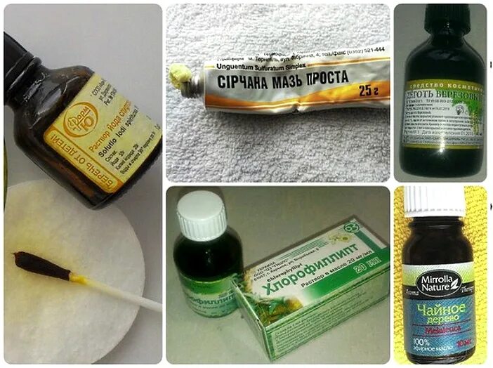 2% спиртовой раствор йода. Средство от лишая у человека. Цветной отрубевидный лишай мазь. Чем лечить лишай у человека народными. Как лечить лишай народными средствами.