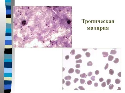 Возбудителем тропической малярии является