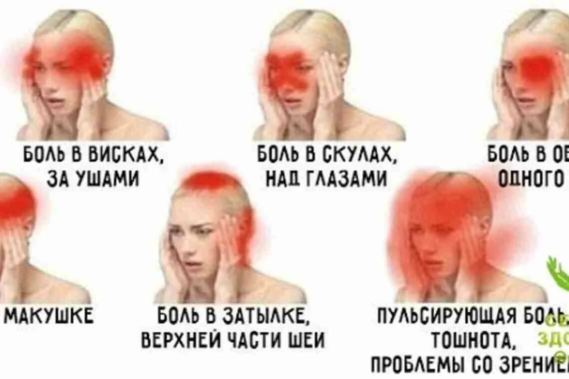 Болит левый висок головы у женщин. Боль в висках головы. Боль в затылке. Головная боль в затылке и висках. Боль в затылочной части головы.