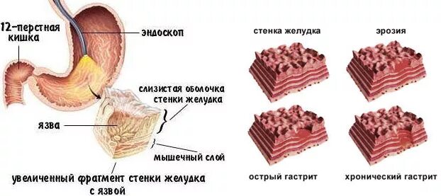 Желудка болит что надо делать