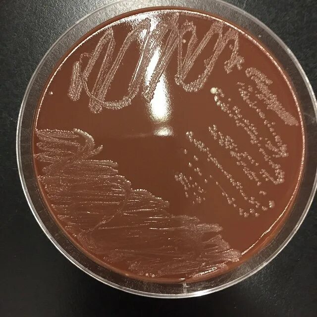 Шоколадный агар. Haemophilus influenzae на агаре. рост haemophilus influenzae шоколадный агар. шоколадный агар (h. influenza. haemophilus influenzae на шоколадном агаре.
