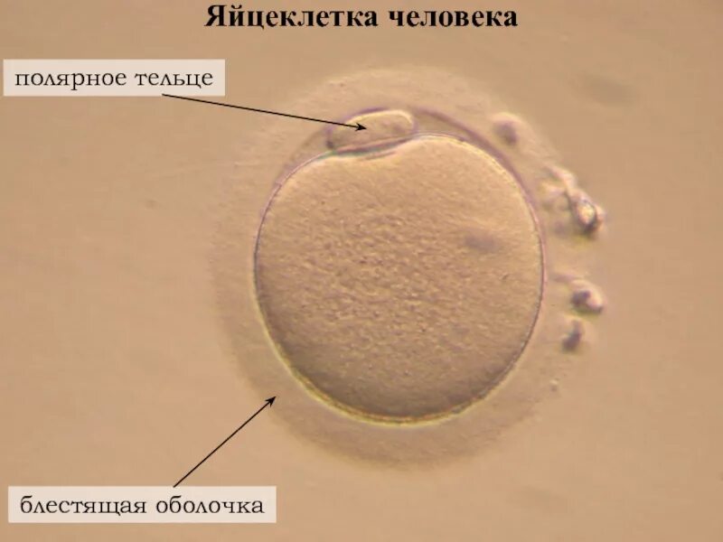 Каким номером обозначено полярное тельце. Zona pellucida яйцеклетки. Полярное тельце в яйцеклетке. Оболочки яйцеклетки человека. Строение яйцеклетки человека.