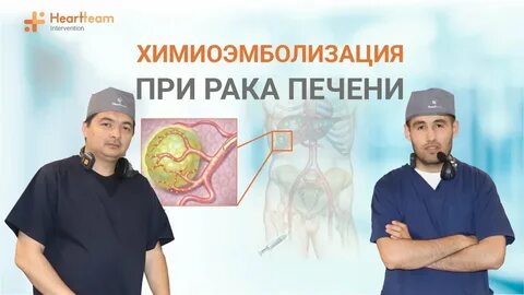 Химиоэмболизация печени отзывы