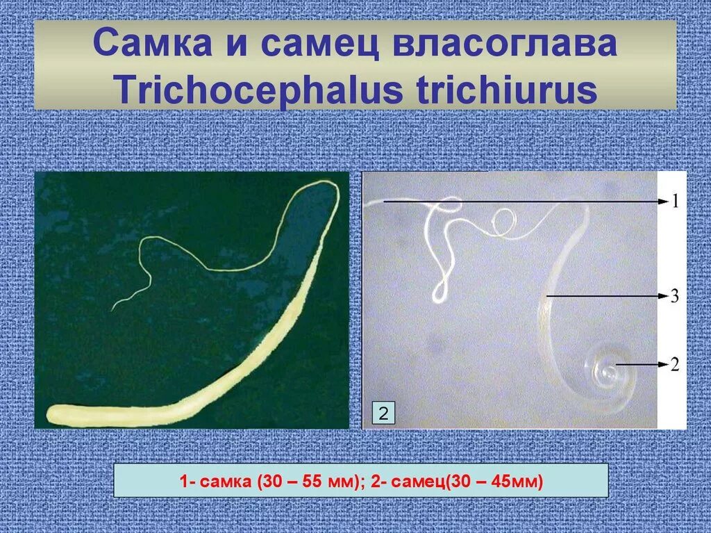 Власоглав это. Власоглав человеческий (Trichocephalus Trichiurus). Власоглав самец и самка препарат. Трихоцефалез строение. Самка Trichocephalus Trichiurus.