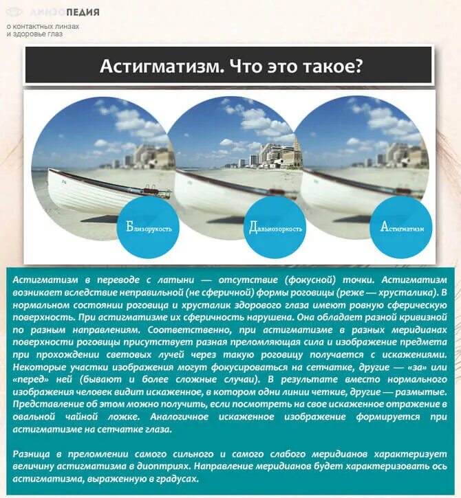 Астигматизм симптомы у взрослых. Астигматизм. роговичный астигматизм. хрусталиковый астигматизм. астигматизм это простыми словами.