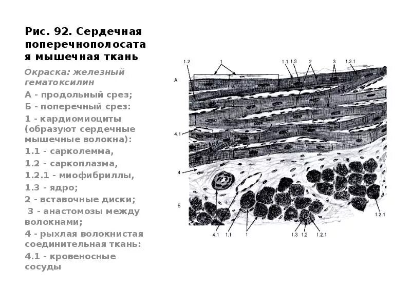 Поперечнополосатая мышечная ткань сердца. Сердечная мышечная ткань окраска Железный гематоксилин. Поперечно полосатая мышечная ткань Железный гематоксилин. Поперечно полосатая сердечная мышечная ткань Железный гематоксилин. Препарат сердечная мышечная ткань Железный гематоксилин.