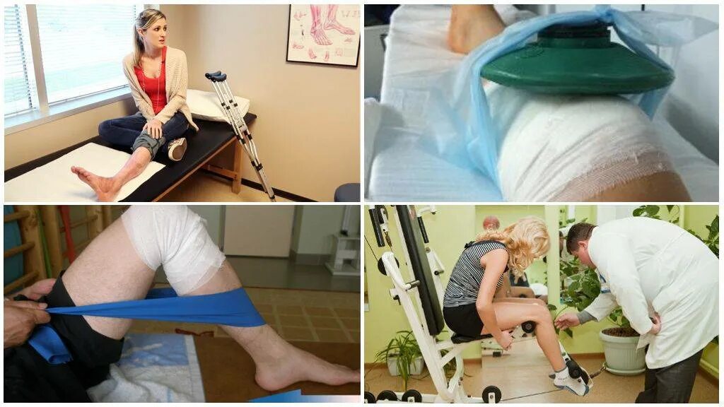 Реабилитация коленного сустава. Реабилитация после операции на коленном. Разработка коленного сустава после эндопротезирования. Реабилитация колена после операции.