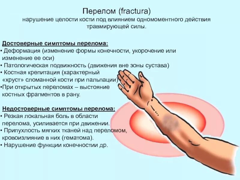 Симптом патологической подвижности