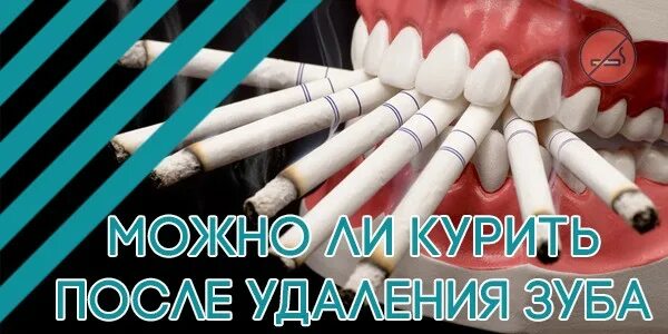 Можно ли электронную сигарету после удаления зуба. Можно ли курить после удаления зуба. можно курить после удаления зуба.