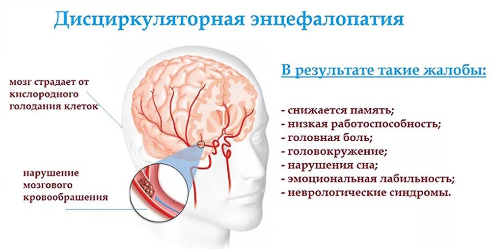 Необратимые нарушения головного мозга