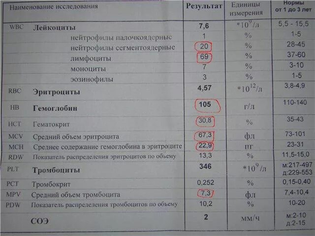 Обычный анализ крови показывает вич. Лейкоз анализ крови показатели. Показатели крови при лейкозе у детей. Показатели клинического анализа крови лейкозе.. ОАК при лейкозе у взрослых показатели.