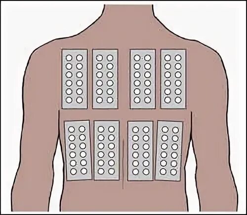 Patch method