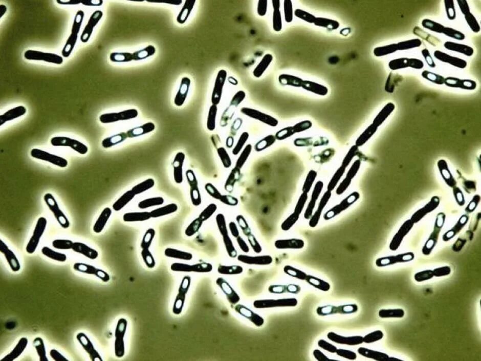 Палочка цереус (Bacillus Cereus). Бактерии Bacillus subtilis. Сенная палочка микроскопия. Bacillus Cereus патогенность.