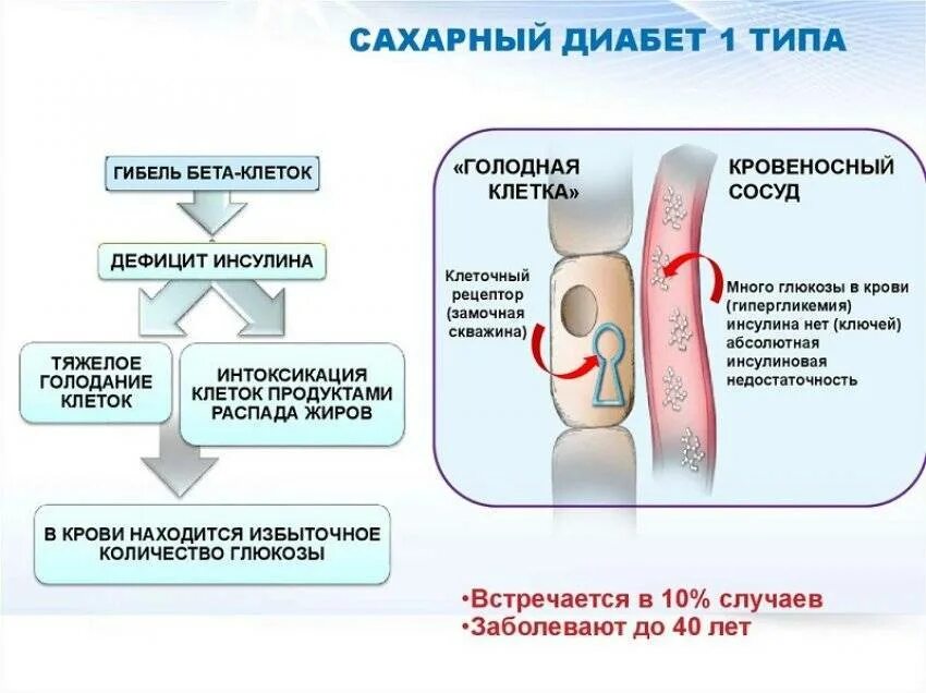 Функции сахарного диабета. Сахар при сахарном диабете 1 типа. формы сахарного диабета 1 типа. сахарный диабет первого типа причины. причины сд 1 типа.