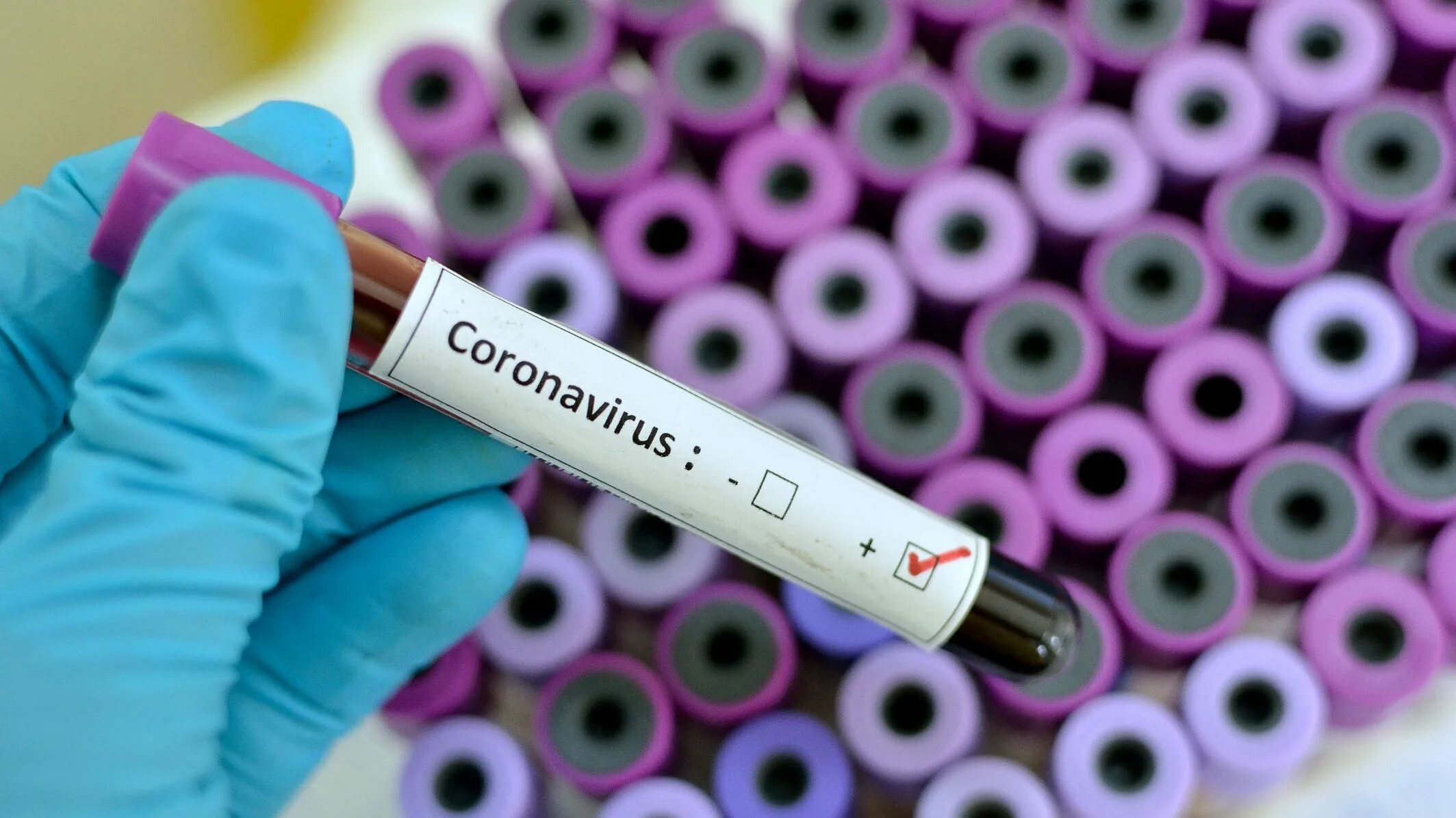 Virus testing. Coronavirus 19. Тестирование на вирус. Covid-19. Коронавирус Covid.