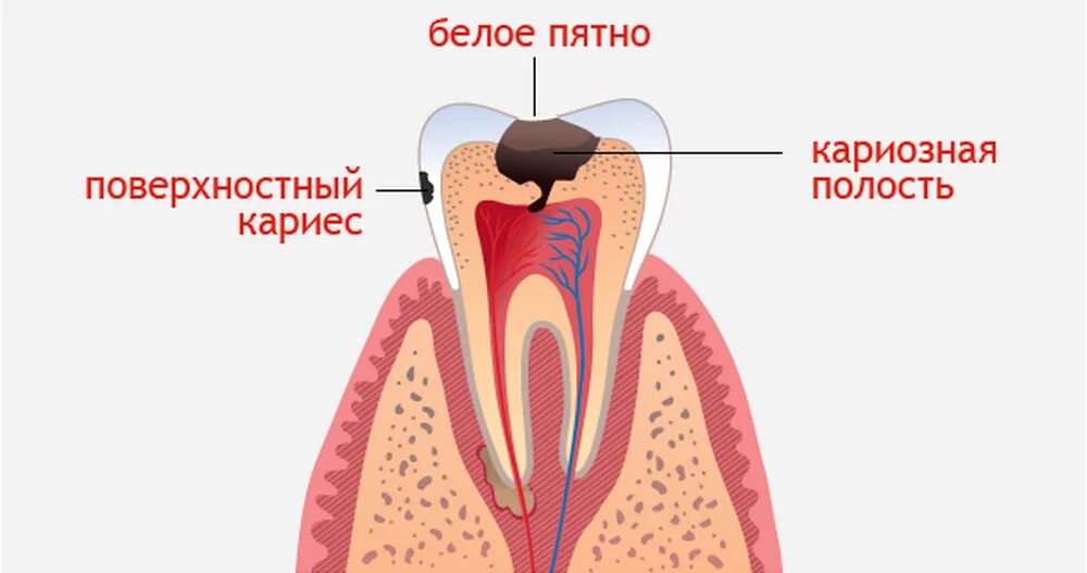 Зуб пульсирует и болит. Зуб пульсирует и болит