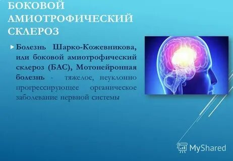 Боковой амиотрофический склероз клинические рекомендации