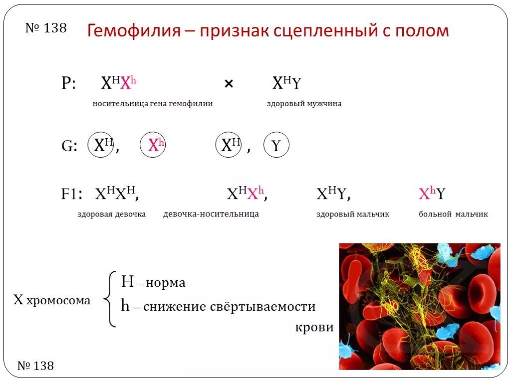 Гемофилия это признак сцепленный с