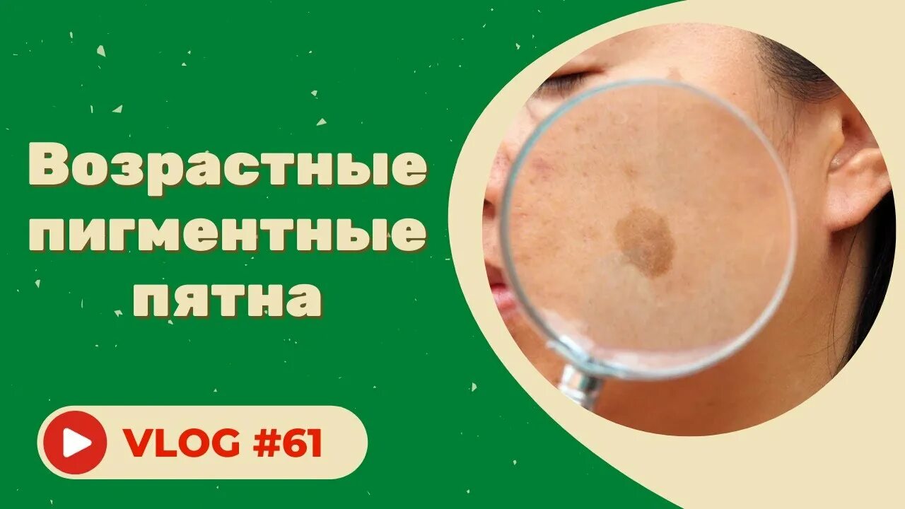 Избавиться от пигментных пятен навсегда. Возрастные пигментные пятна. пигментные пятна на лице при болезни печени. возрастные пигментные пятна на лице как избавиться. как убрать возрастные пигментные пятна в домашних условиях.