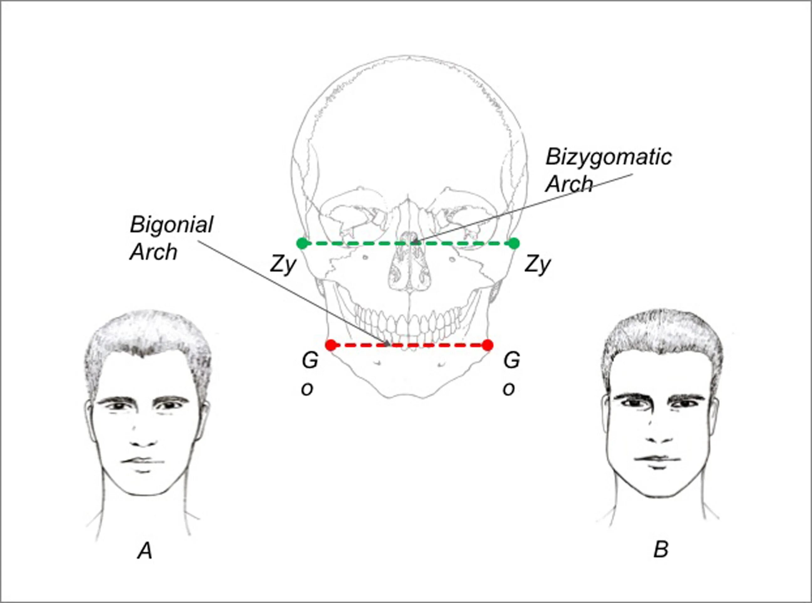 Антропометрические точки лица в ортодонтии. Ширина лица. Высота и ширина лица. Измерение ширины лица по Изару.