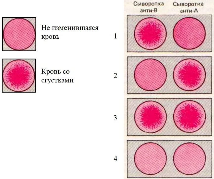 Антитела плазмы 1 группы крови. Цвета групп крови. Группы крови по системе ав0. 1. Группы крови по системе ав0..