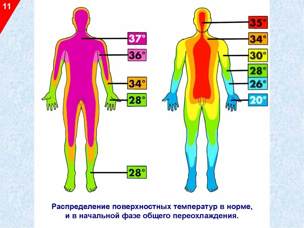 Восприятие температуры человеком. Общее охлаждение организма. Общее переохлаждение организма. Охлаждение тела человека. Степени общего охлаждения организма.