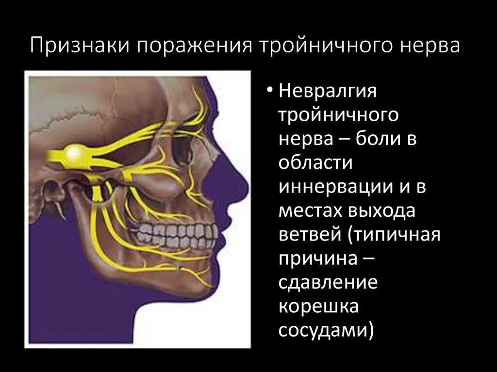 Поражение 3 нерва. Симптомы поражения ветвей тройничного нерва. Симптомы поражения 2 ветви тройничного нерва. Неврология тройничный нерв симптомы. V пара, тройничный нерв.